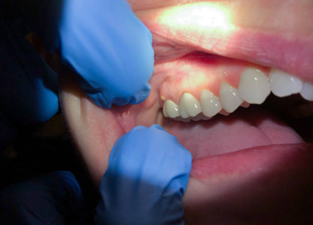 Best Emergency Broken Tooth Repair in Dover, DE